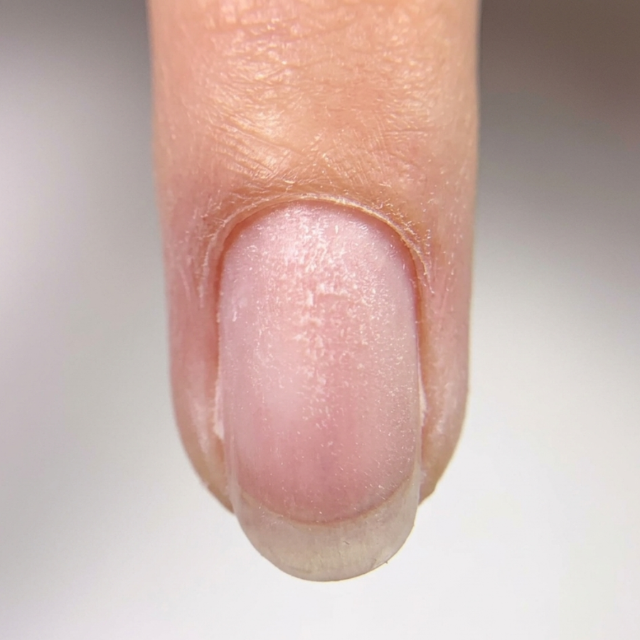 ANALYSE DE L’ONGLE